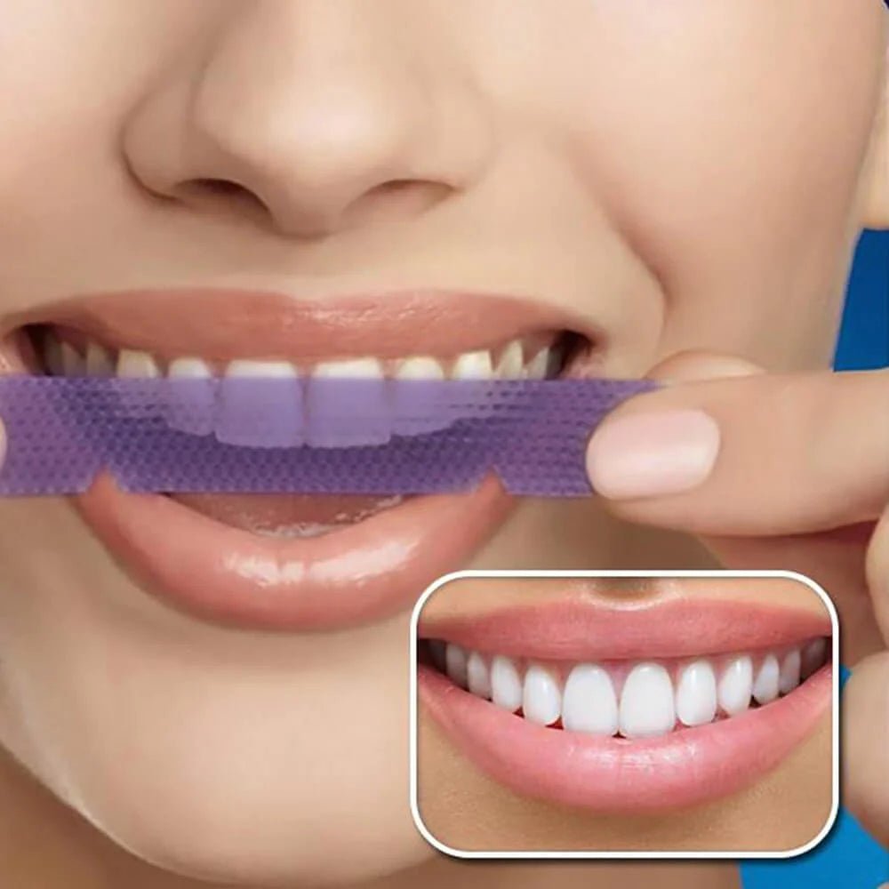 Bandes Blanchissante V34 - WeSmile