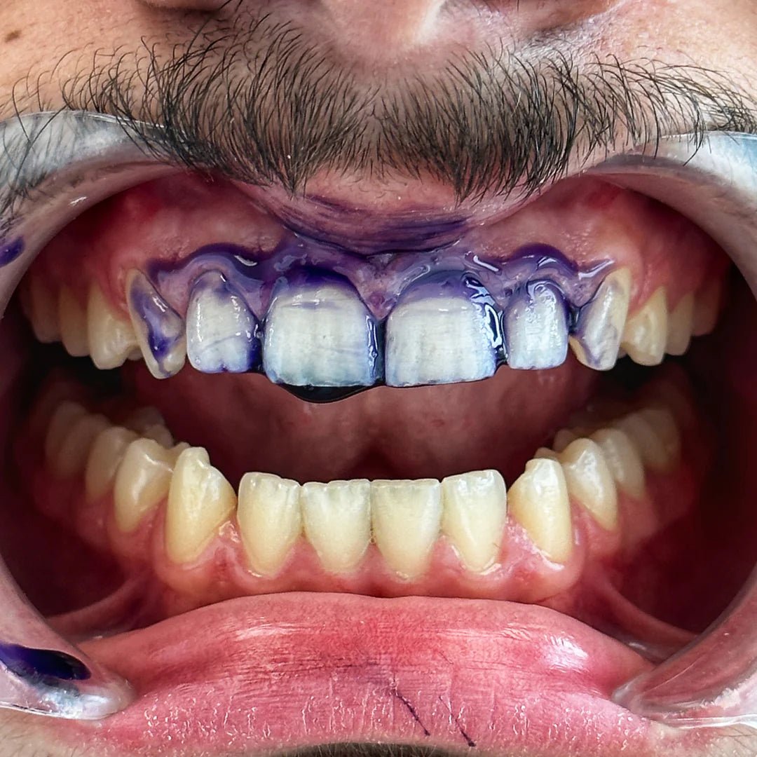 Pack White - WeSmile