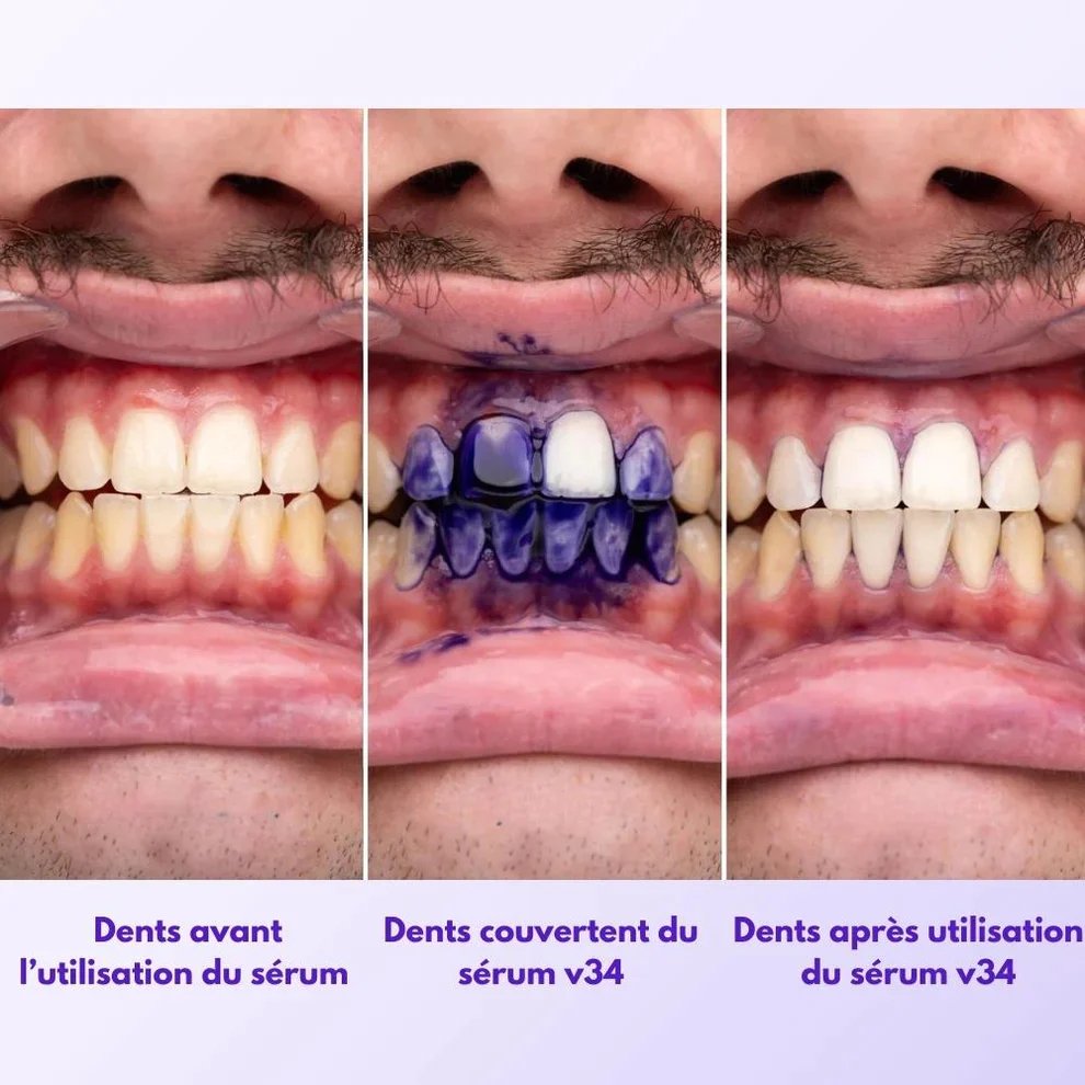 Pack White - WeSmile