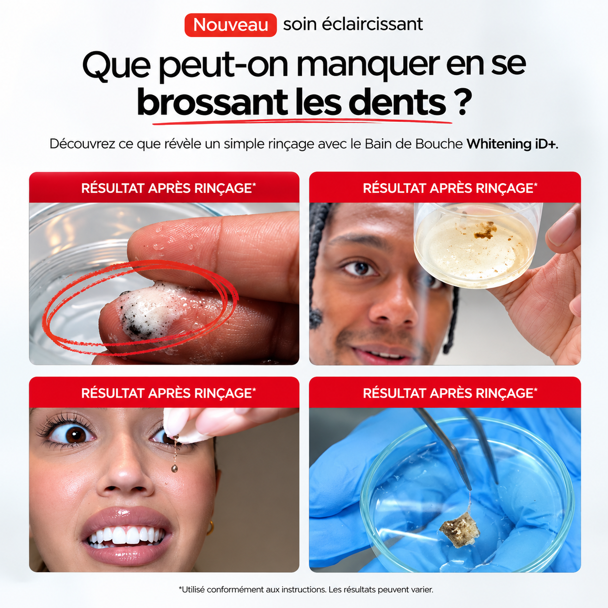 Pack de 3 – Bains de Bouche Blanchissants iD+